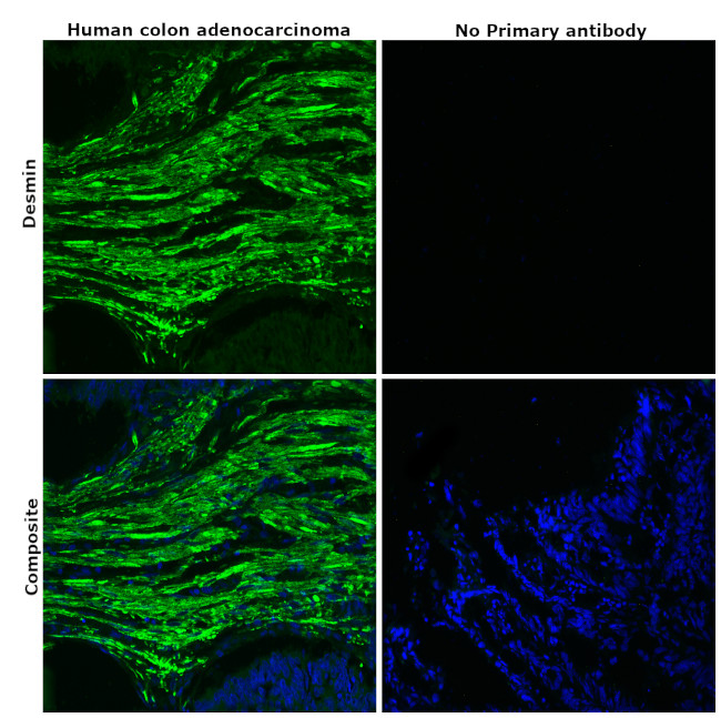 Desmin Antibody in Immunohistochemistry (Paraffin) (IHC (P))