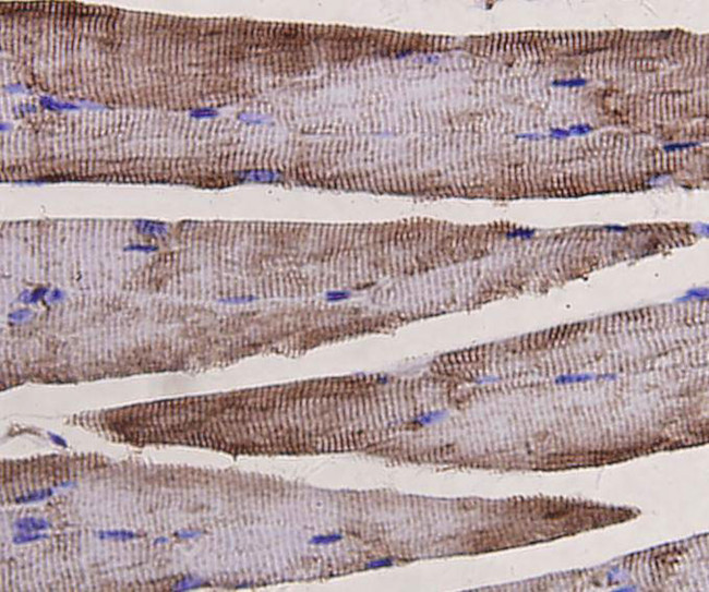 Desmin Antibody in Immunohistochemistry (Paraffin) (IHC (P))