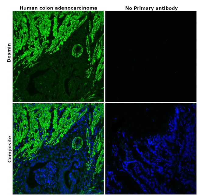 Desmin Antibody in Immunohistochemistry (Paraffin) (IHC (P))