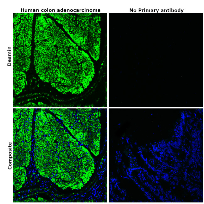 Desmin Antibody in Immunohistochemistry (Paraffin) (IHC (P))