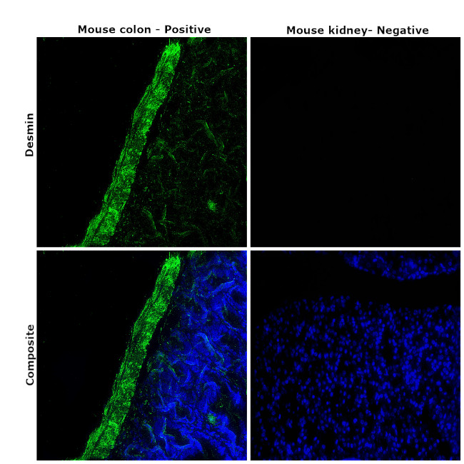 Desmin Antibody in Immunohistochemistry (Paraffin) (IHC (P))