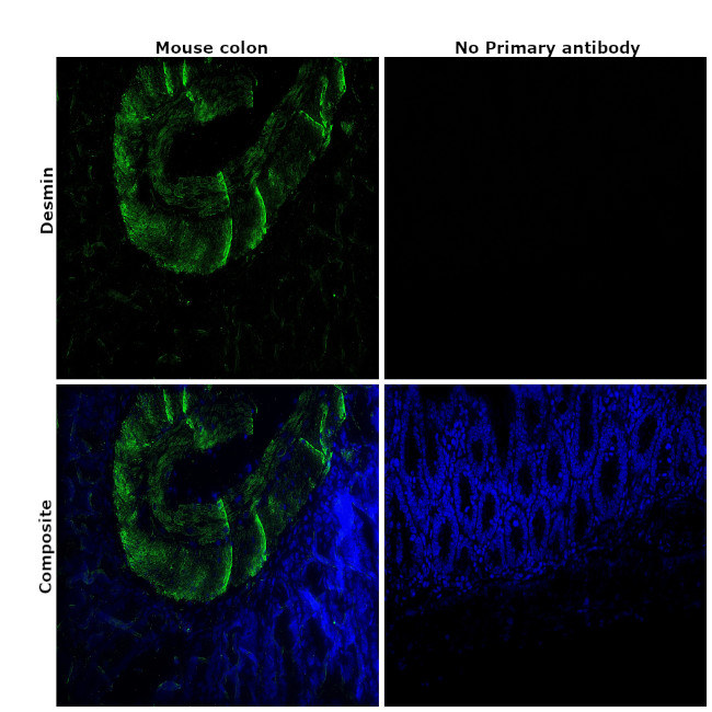 Desmin Antibody in Immunohistochemistry (Paraffin) (IHC (P))