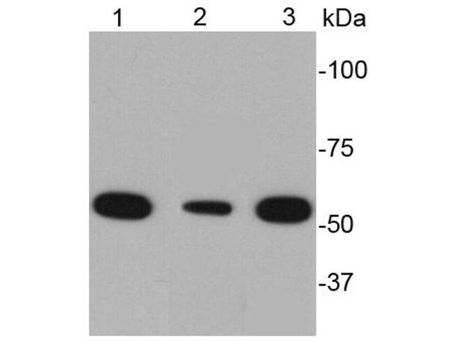 Desmin Antibody in Western Blot (WB)