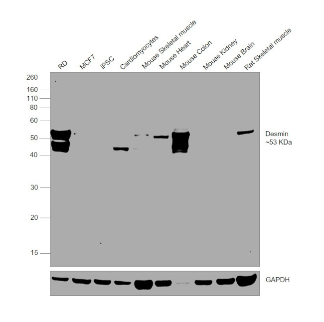 Desmin Antibody in Western Blot (WB)