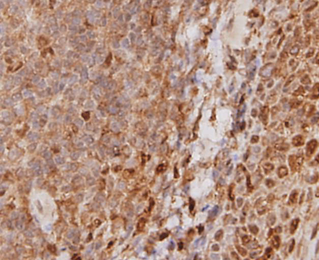 STAT6 Antibody in Immunohistochemistry (Paraffin) (IHC (P))