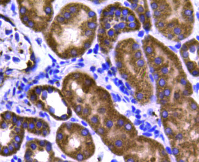 STAT6 Antibody in Immunohistochemistry (Paraffin) (IHC (P))