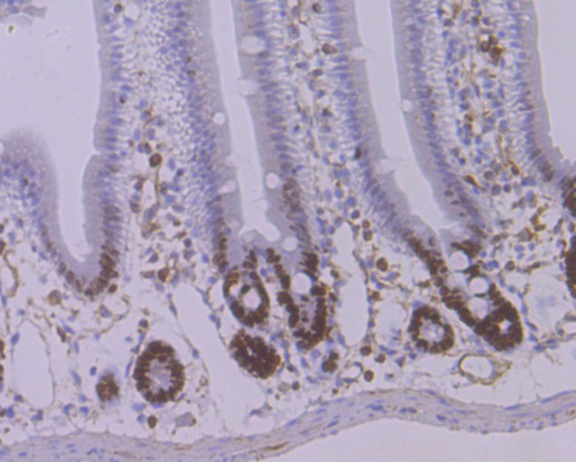 STAT6 Antibody in Immunohistochemistry (Paraffin) (IHC (P))