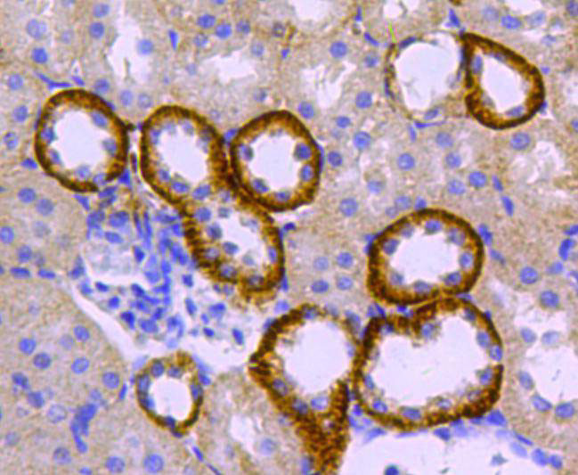 Catalase Antibody in Immunohistochemistry (Paraffin) (IHC (P))