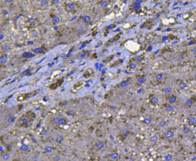 Catalase Antibody in Immunohistochemistry (Paraffin) (IHC (P))