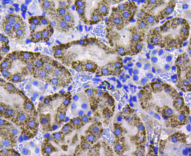 Catalase Antibody in Immunohistochemistry (Paraffin) (IHC (P))