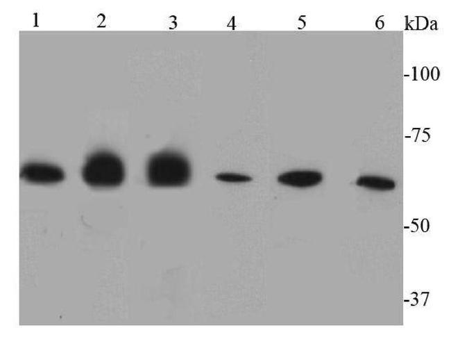 Catalase Antibody in Western Blot (WB)