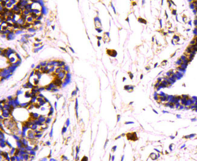 HSP70 Antibody in Immunohistochemistry (Paraffin) (IHC (P))