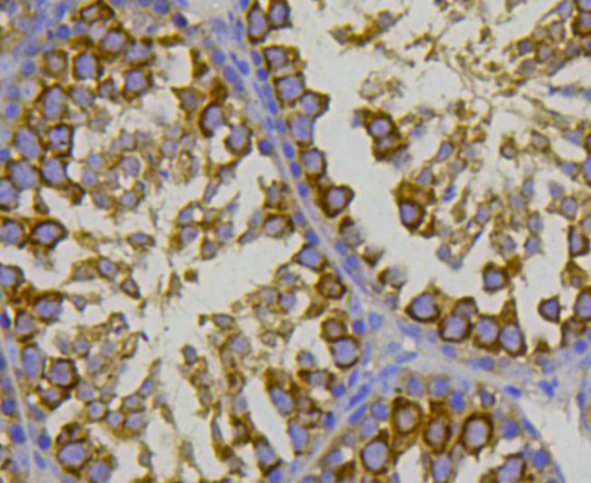 HSP70 Antibody in Immunohistochemistry (Paraffin) (IHC (P))