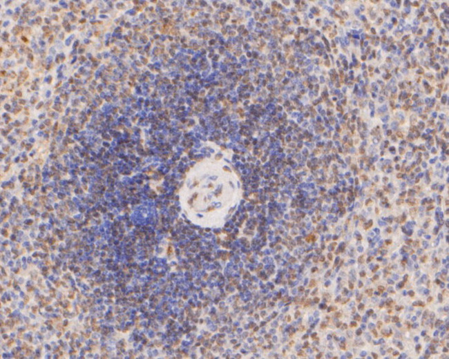 NAT13 Antibody in Immunohistochemistry (Paraffin) (IHC (P))