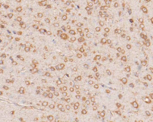 NAT13 Antibody in Immunohistochemistry (Paraffin) (IHC (P))