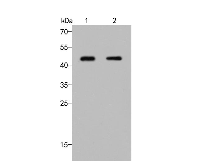 RAD51B Antibody in Western Blot (WB)