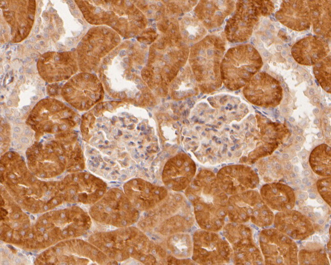 SPTBN1 Antibody in Immunohistochemistry (Paraffin) (IHC (P))