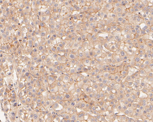 SPTBN1 Antibody in Immunohistochemistry (Paraffin) (IHC (P))