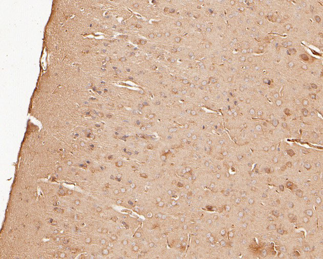 SPTBN1 Antibody in Immunohistochemistry (Paraffin) (IHC (P))