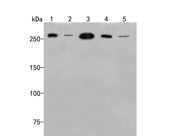 SPTBN1 Antibody in Western Blot (WB)