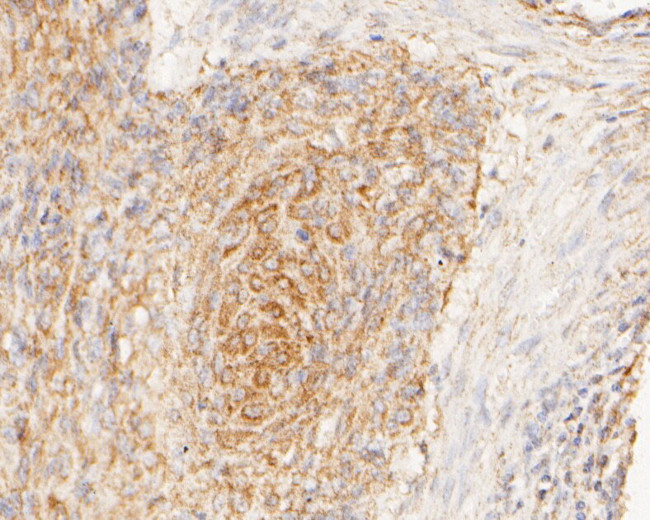 GRIK4 Antibody in Immunohistochemistry (Paraffin) (IHC (P))