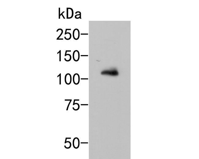 GRIK4 Antibody in Western Blot (WB)