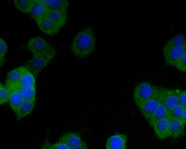 SAPAP1 Antibody in Immunocytochemistry (ICC/IF)