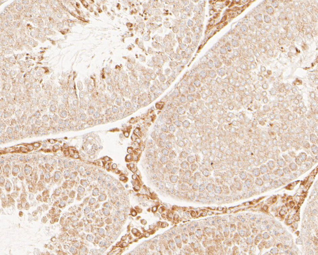 SAPAP1 Antibody in Immunohistochemistry (Paraffin) (IHC (P))