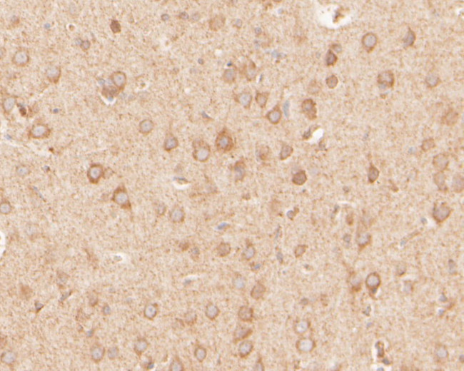 SAPAP1 Antibody in Immunohistochemistry (Paraffin) (IHC (P))