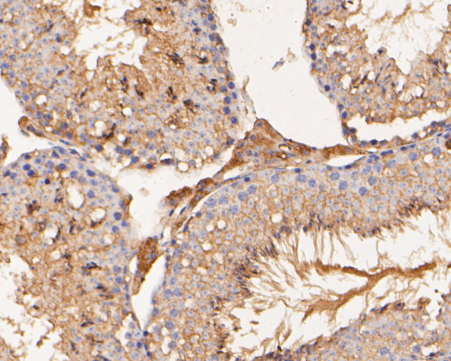 SAPAP1 Antibody in Immunohistochemistry (Paraffin) (IHC (P))