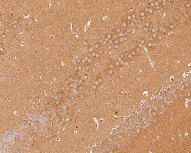 SAPAP1 Antibody in Immunohistochemistry (Paraffin) (IHC (P))