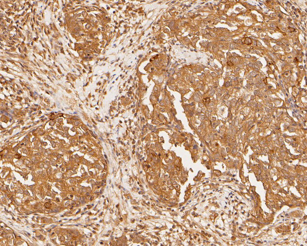 PDCD6 Antibody in Immunohistochemistry (Paraffin) (IHC (P))