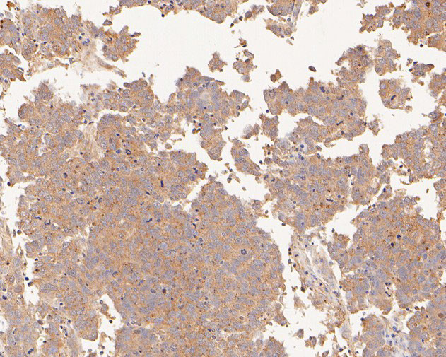 PDCD6 Antibody in Immunohistochemistry (Paraffin) (IHC (P))