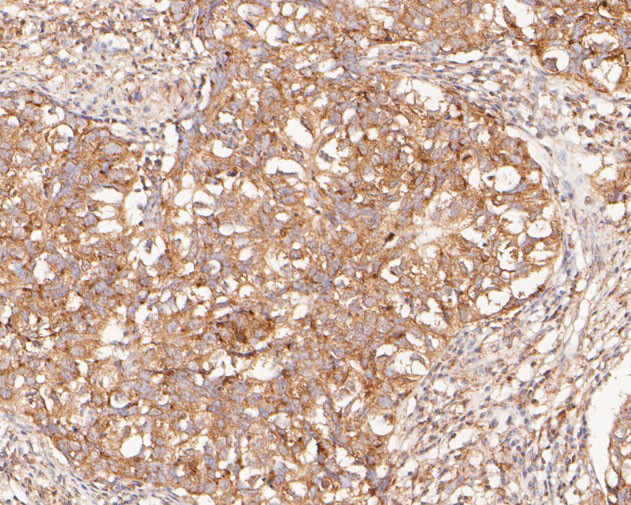 NAT1 Antibody in Immunohistochemistry (Paraffin) (IHC (P))