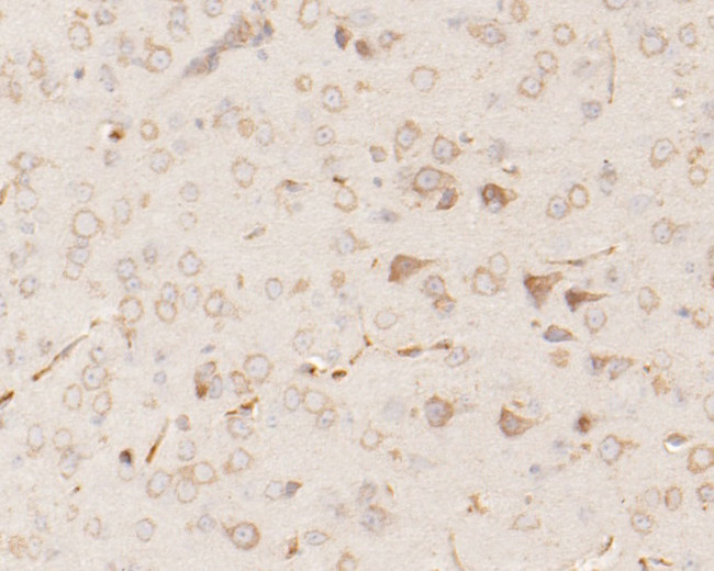 RARS Antibody in Immunohistochemistry (Paraffin) (IHC (P))