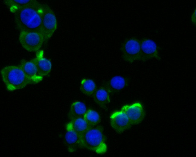 PKP3 Antibody in Immunocytochemistry (ICC/IF)