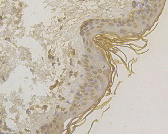 PKP3 Antibody in Immunohistochemistry (Paraffin) (IHC (P))