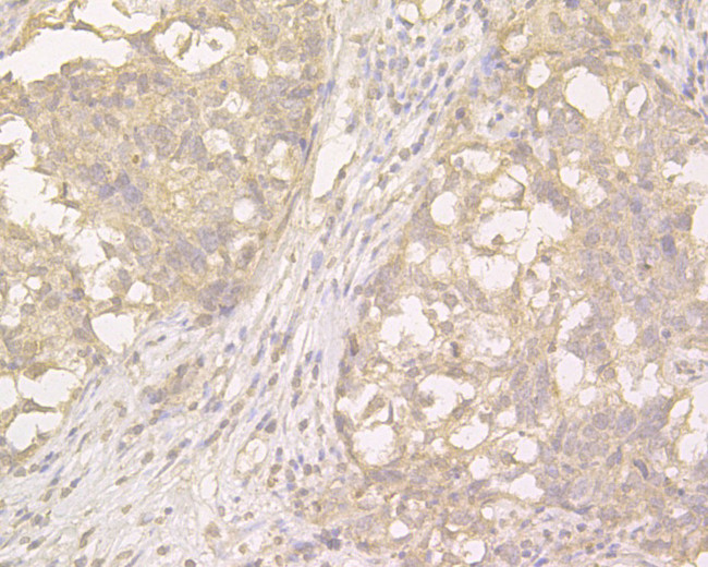 PKP3 Antibody in Immunohistochemistry (Paraffin) (IHC (P))