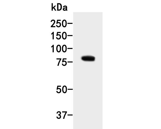 PKP3 Antibody in Western Blot (WB)