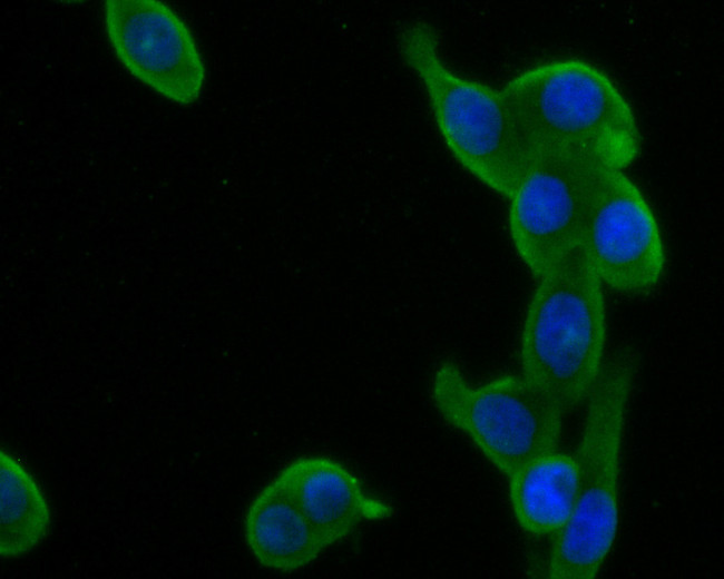 GFPT1 Antibody in Immunocytochemistry (ICC/IF)