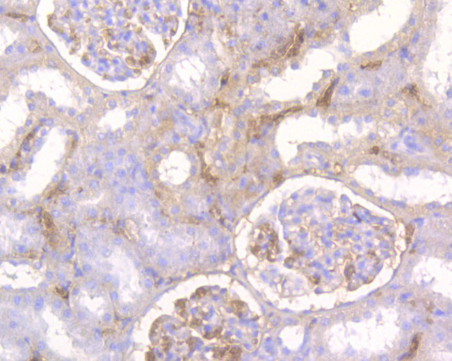 GFPT1 Antibody in Immunohistochemistry (Paraffin) (IHC (P))