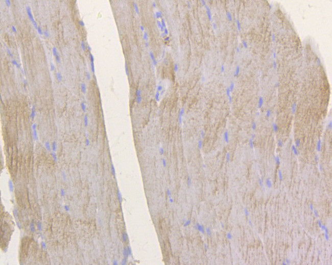 GFPT1 Antibody in Immunohistochemistry (Paraffin) (IHC (P))