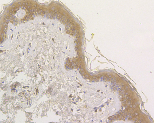 OAS3 Antibody in Immunohistochemistry (Paraffin) (IHC (P))