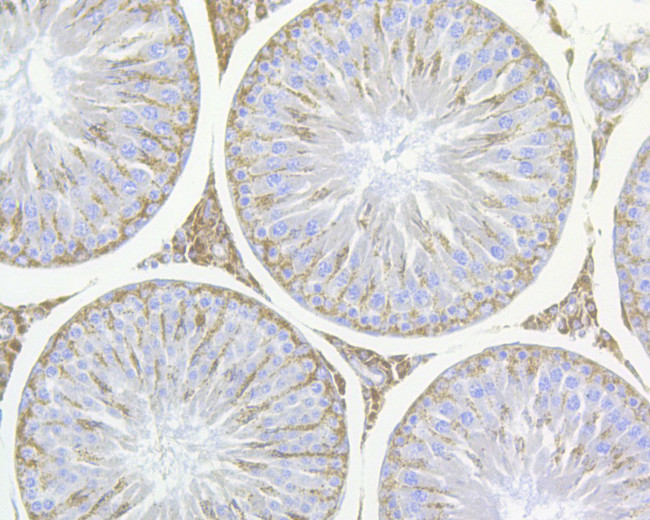 Nodal Antibody in Immunohistochemistry (Paraffin) (IHC (P))