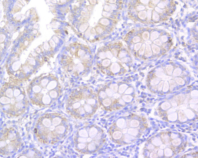 Nodal Antibody in Immunohistochemistry (Paraffin) (IHC (P))