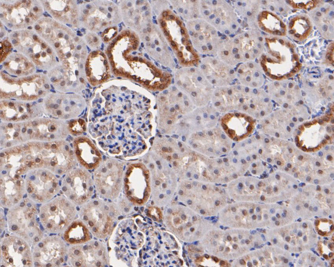 MST1 (STK4) Antibody in Immunohistochemistry (Paraffin) (IHC (P))