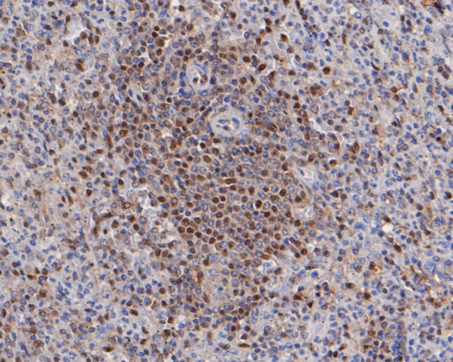 MST1 (STK4) Antibody in Immunohistochemistry (Paraffin) (IHC (P))