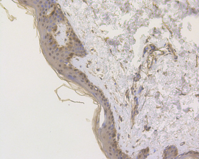 S100A2 Antibody in Immunohistochemistry (Paraffin) (IHC (P))