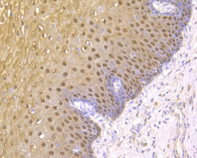 S100A2 Antibody in Immunohistochemistry (Paraffin) (IHC (P))