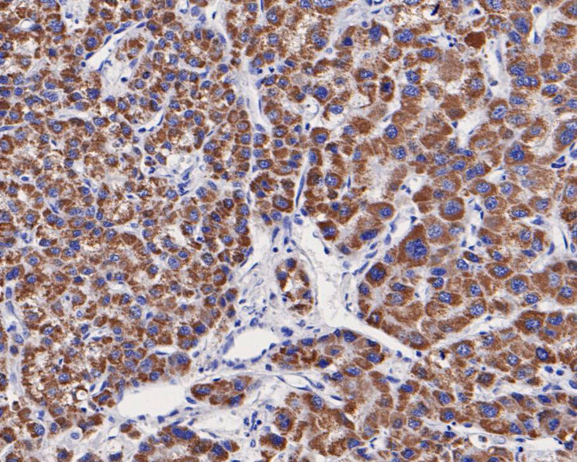 OTC Antibody in Immunohistochemistry (Paraffin) (IHC (P))